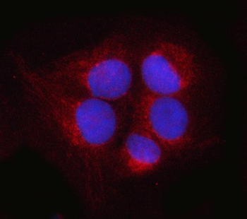 POH1/PSMD14 Rabbit Polyclonal Antibody