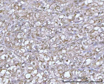 POH1/PSMD14 Rabbit Polyclonal Antibody