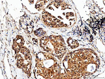 POH1/PSMD14 Rabbit Polyclonal Antibody
