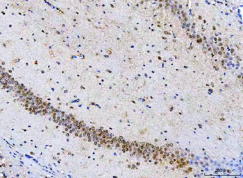 POH1/PSMD14 Rabbit Polyclonal Antibody