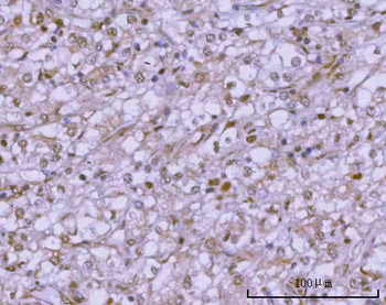 PSMC4 Rabbit Polyclonal Antibody