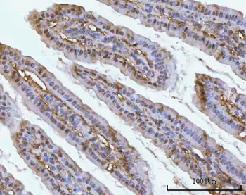 PSMC4 Rabbit Polyclonal Antibody