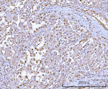 PSMA1 Rabbit Polyclonal Antibody
