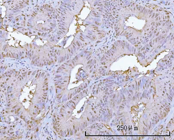PSMA1 Rabbit Polyclonal Antibody