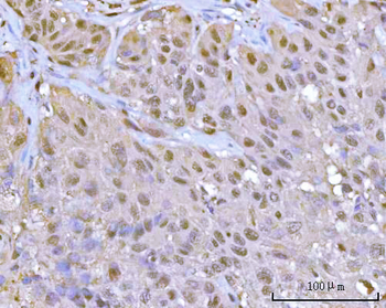 PSMA1 Rabbit Polyclonal Antibody