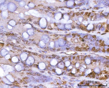PSMA1 Rabbit Polyclonal Antibody