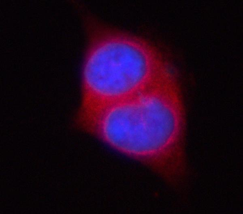 PSAT1 Rabbit Polyclonal Antibody