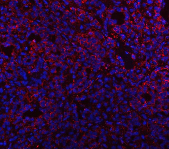 PSAP Rabbit Polyclonal Antibody