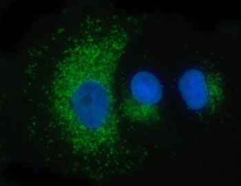 PSAP Rabbit Polyclonal Antibody