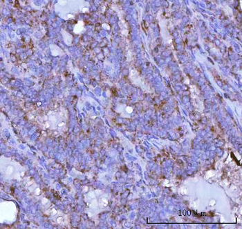 PSAP Rabbit Polyclonal Antibody