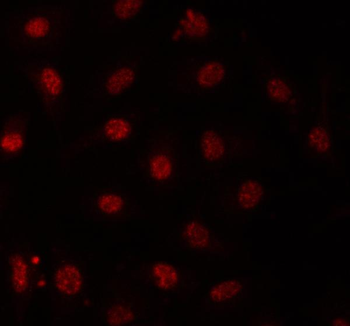 PRPF31 Rabbit Polyclonal Antibody