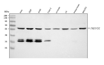 PRPF31 Rabbit Polyclonal Antibody