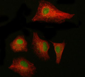 NAB1 Rabbit Polyclonal Antibody