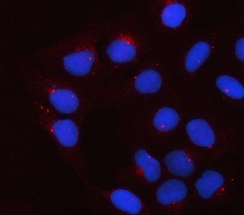 APOE Rabbit Polyclonal Antibody
