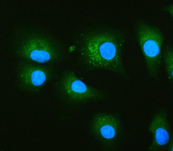 PRKCSH Rabbit Polyclonal Antibody
