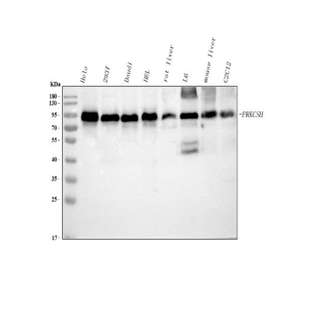 PRKCSH Rabbit Polyclonal Antibody