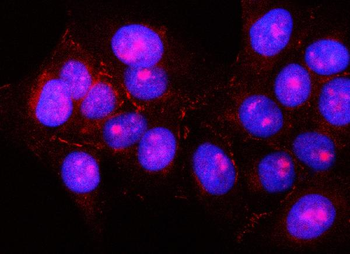 PNLIPRP2 Rabbit Polyclonal Antibody