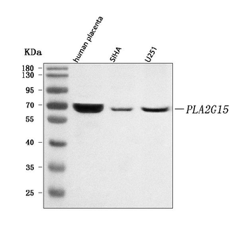 LYPLA3/PLA2G15 Rabbit Polyclonal Antibody