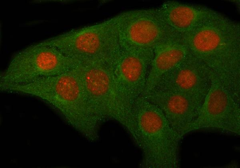 OVOL2 Rabbit Polyclonal Antibody