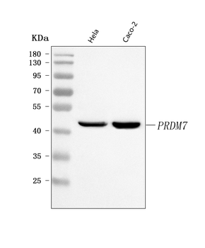 PRDM7 Rabbit Polyclonal Antibody