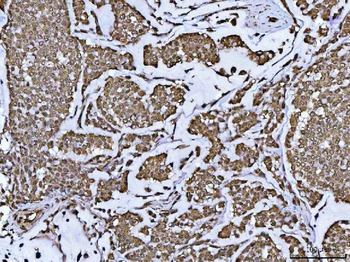 PPP4C Rabbit Polyclonal Antibody