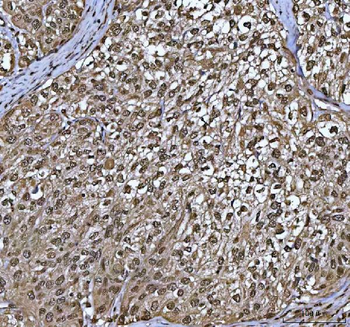 PPP4C Rabbit Polyclonal Antibody
