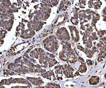 PPP4C Rabbit Polyclonal Antibody