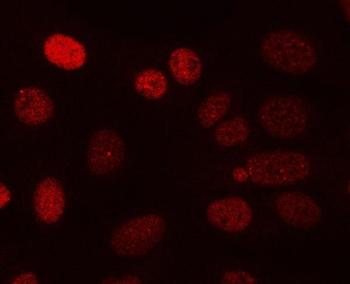 PPP3CA Rabbit Polyclonal Antibody