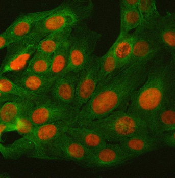 BCL11B Rabbit Polyclonal Antibody