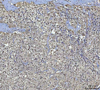BCL11B Rabbit Polyclonal Antibody