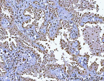 BCL11B Rabbit Polyclonal Antibody