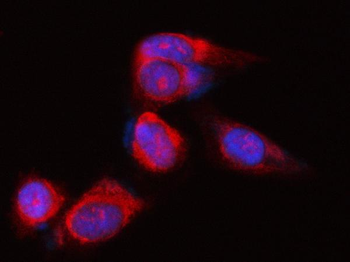 POLR1B Rabbit Polyclonal Antibody
