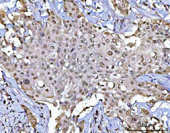 POLR1B Rabbit Polyclonal Antibody