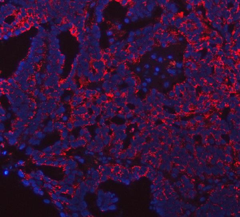 PRDM15 Rabbit Polyclonal Antibody