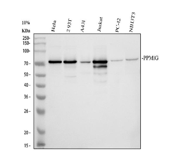 PPM1G Rabbit Polyclonal Antibody