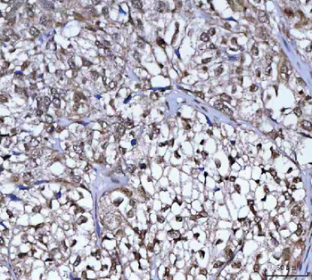 PLEKHA1 Rabbit Polyclonal Antibody