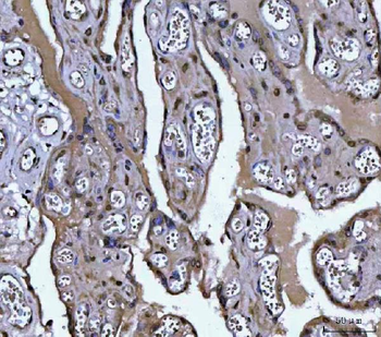 PLEKHA1 Rabbit Polyclonal Antibody