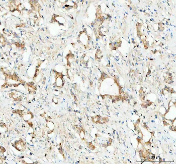GPX1 Rabbit Polyclonal Antibody