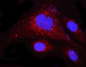 MCL1 Rabbit Polyclonal Antibody