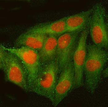 ATF4 Rabbit Polyclonal Antibody
