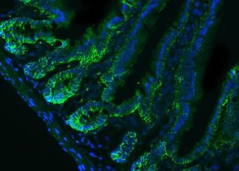 CD326/Epcam Rabbit Polyclonal Antibody