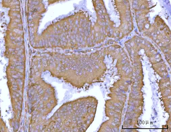 DR5/TNFRSF10B Rabbit Polyclonal Antibody