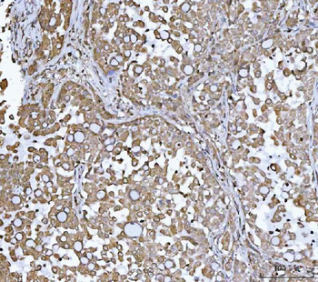 DR5/TNFRSF10B Rabbit Polyclonal Antibody