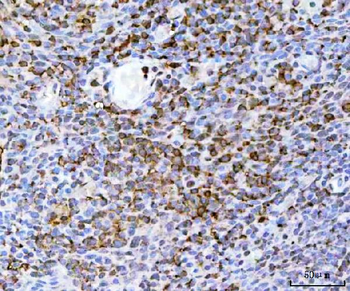 DR5/TNFRSF10B Rabbit Polyclonal Antibody