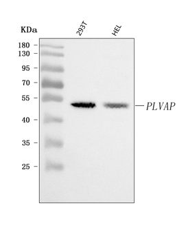PLVAP Rabbit Polyclonal Antibody