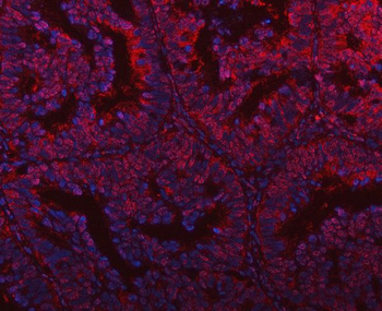 PLEKHG5 Rabbit Polyclonal Antibody