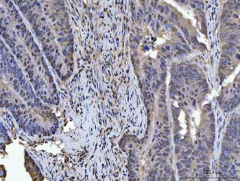 PLEKHG5 Rabbit Polyclonal Antibody