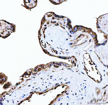 PLEKHG5 Rabbit Polyclonal Antibody
