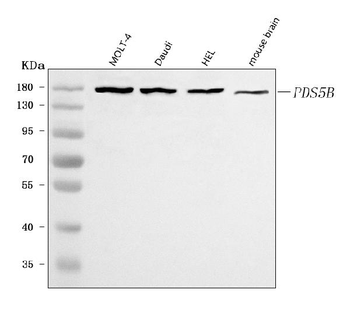 PDS5B Rabbit Polyclonal Antibody