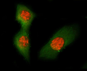 ASC/TMS1/Pycard Rabbit Polyclonal Antibody
